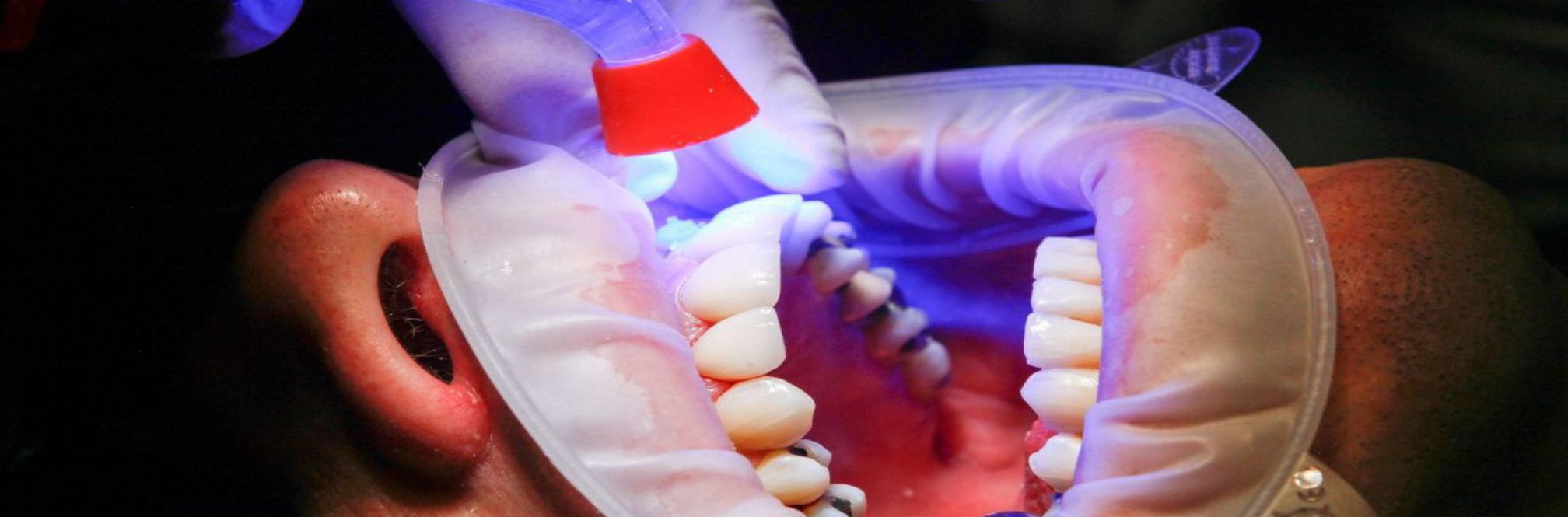 Профилактика и гигиена зубов
